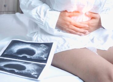 Nuevos avances en el tratamiento de los ovarios poliquísticos, según un artículo publicado por la clínica MARGen